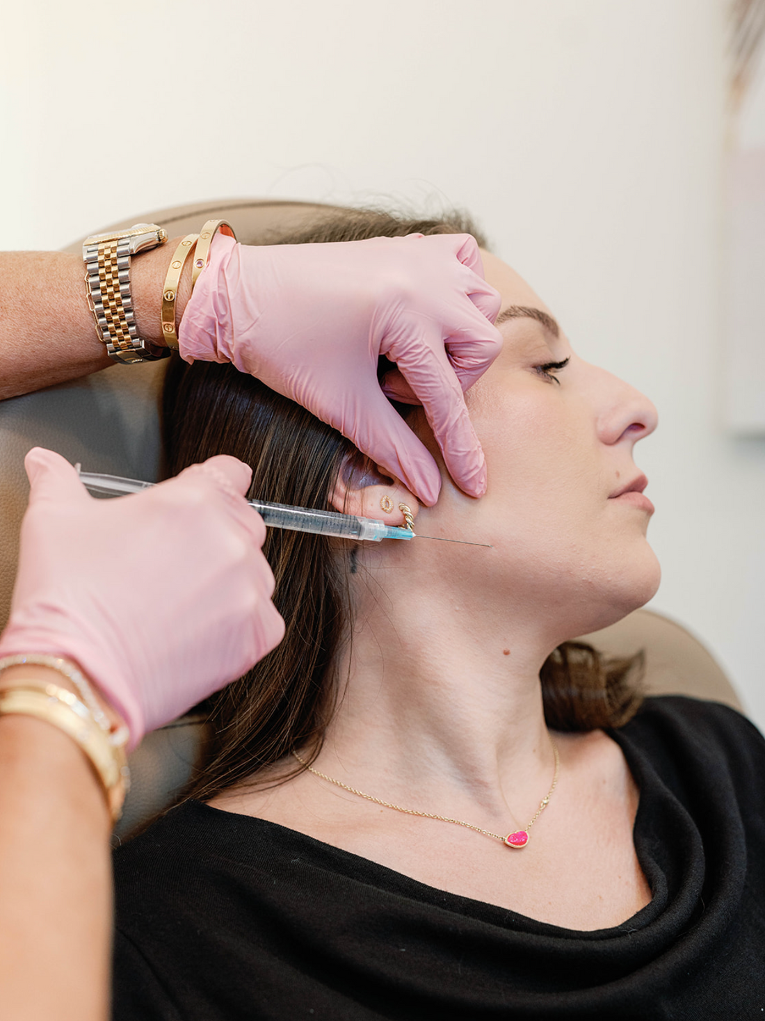 Sculptra: The Subtle Glow-Up You Didn’t Know You Needed