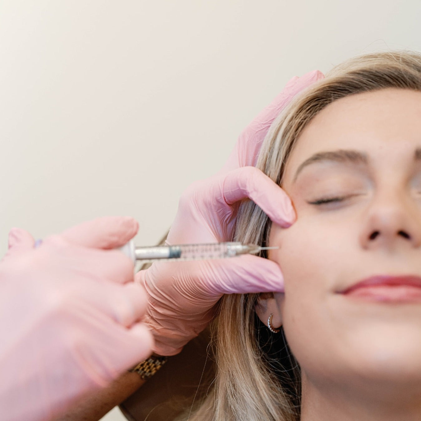 Patient receiving filler treatment at Meg Fox Aesthetics