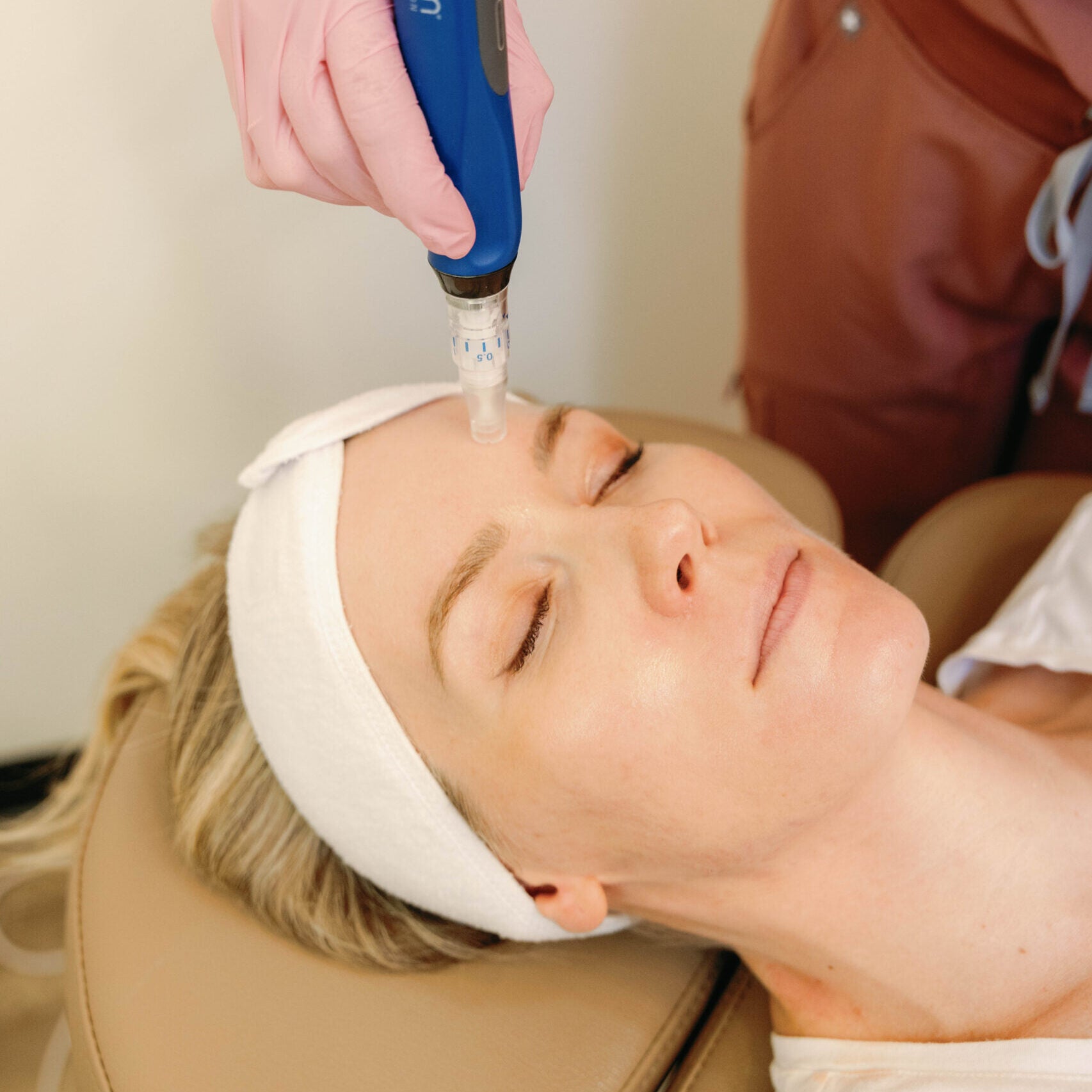 Patient receiving microneedling treatment at Meg Fox Aesthetics