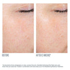 SkinBetter AlphaRet Peel Pads