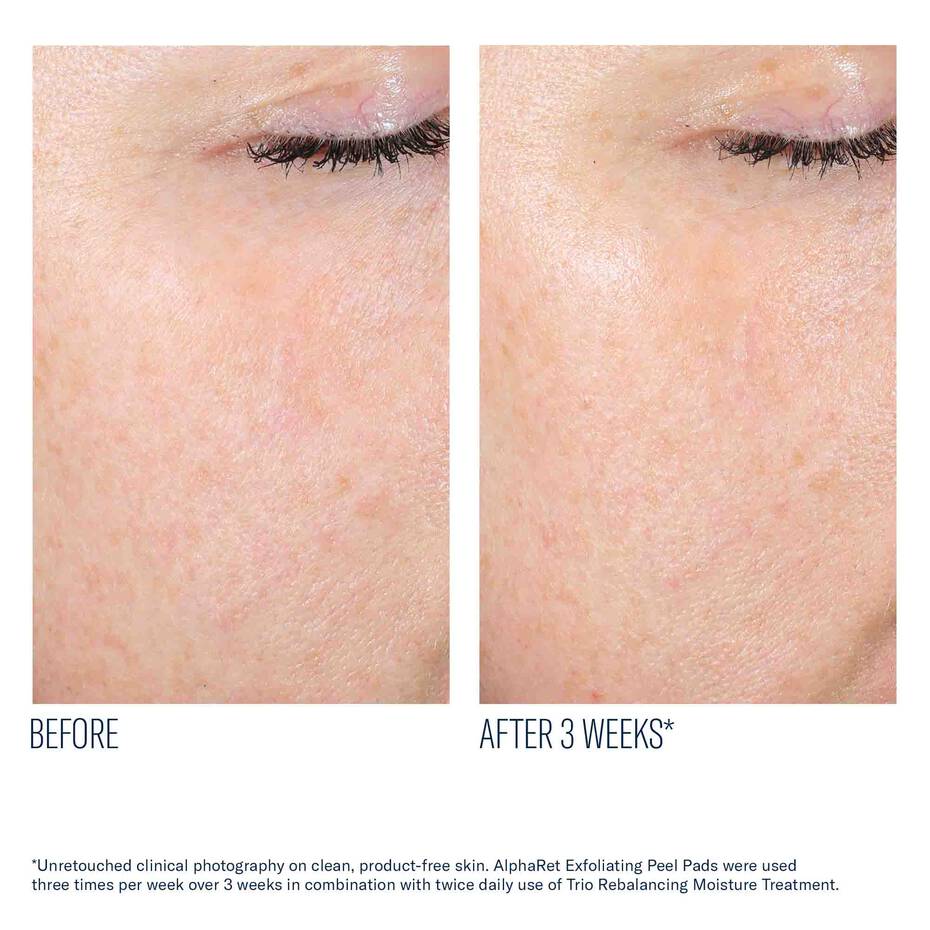 SkinBetter AlphaRet Peel Pads