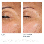 SkinBetter Eyemax AlphaRet Overnight Eye Cream
