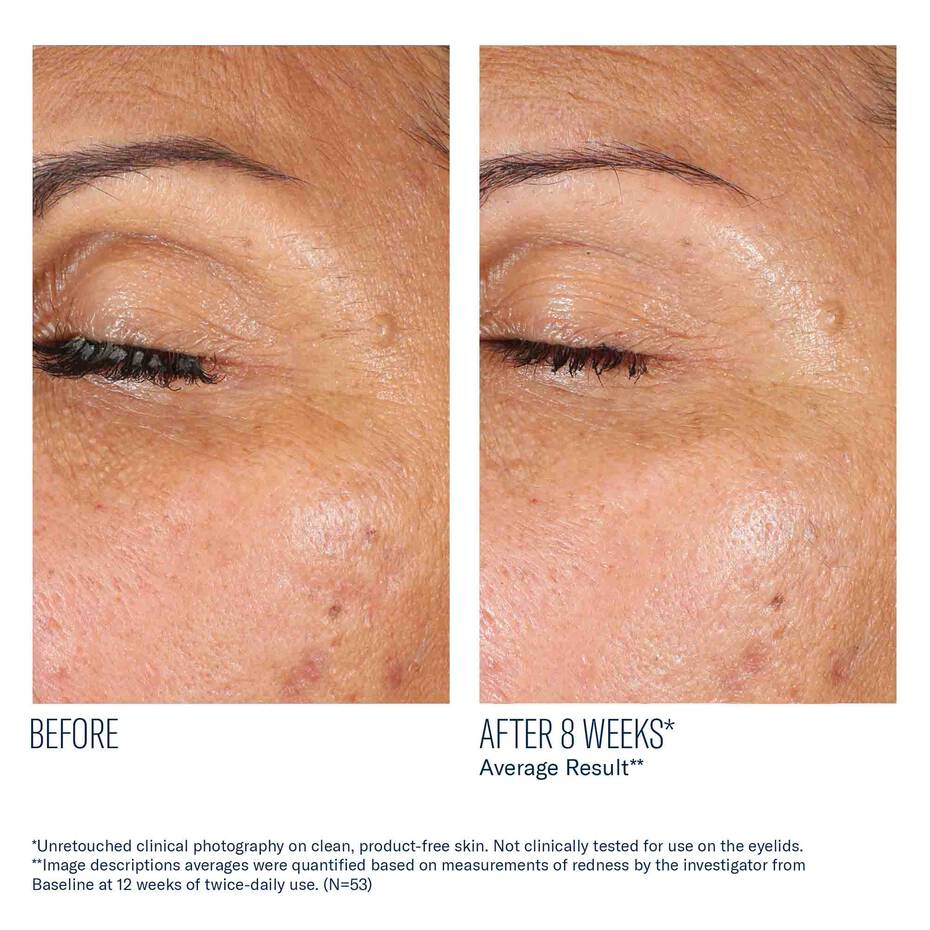 SkinBetter Eyemax AlphaRet Overnight Eye Cream