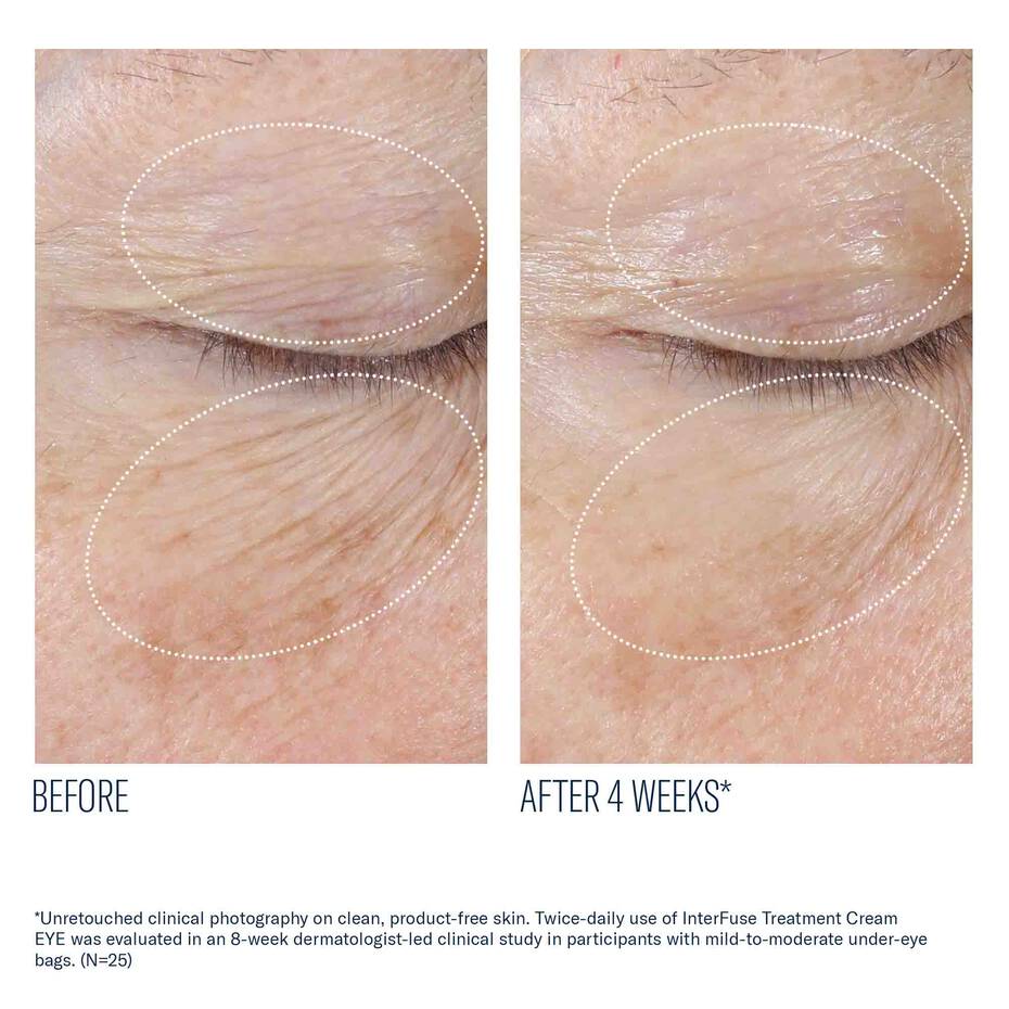 SkinBetter Interfuse Treatment Eye Cream