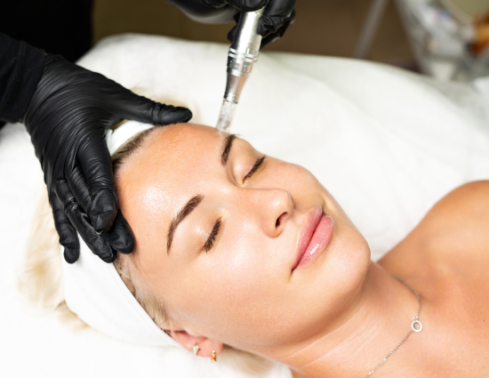 Microneedling in Annapolis