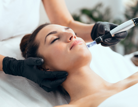 Procedure of Microneedling
